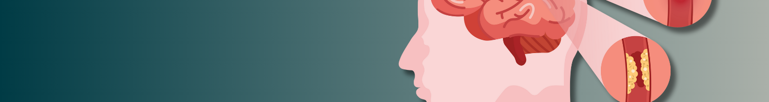 2024-2026 EDW Enduring Program: Stroke Education Banner